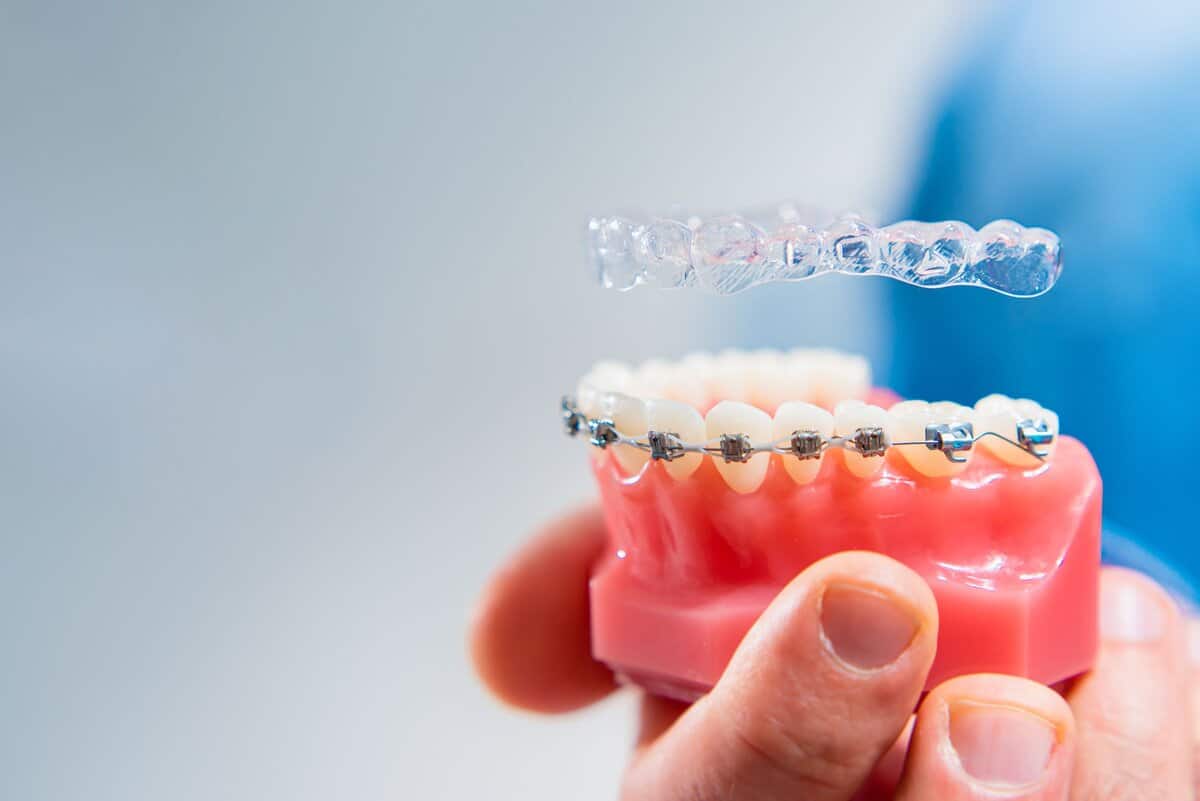 orthodontie1200